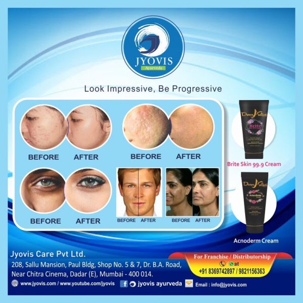 Acnoderm Cream | Face Acne | Back Acne | Acne Pimple Cream